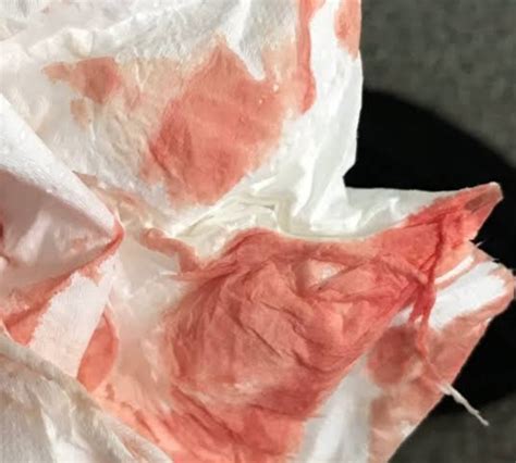 Re If you spotted before your BFP, come in At 14 and 15 DPO which was the day before and the day of my BFP, I had spotting. . Heavy implantation bleeding success stories forum